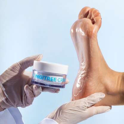 Fungitree Cream 30g -  Antimicotico Para Micose Plantar